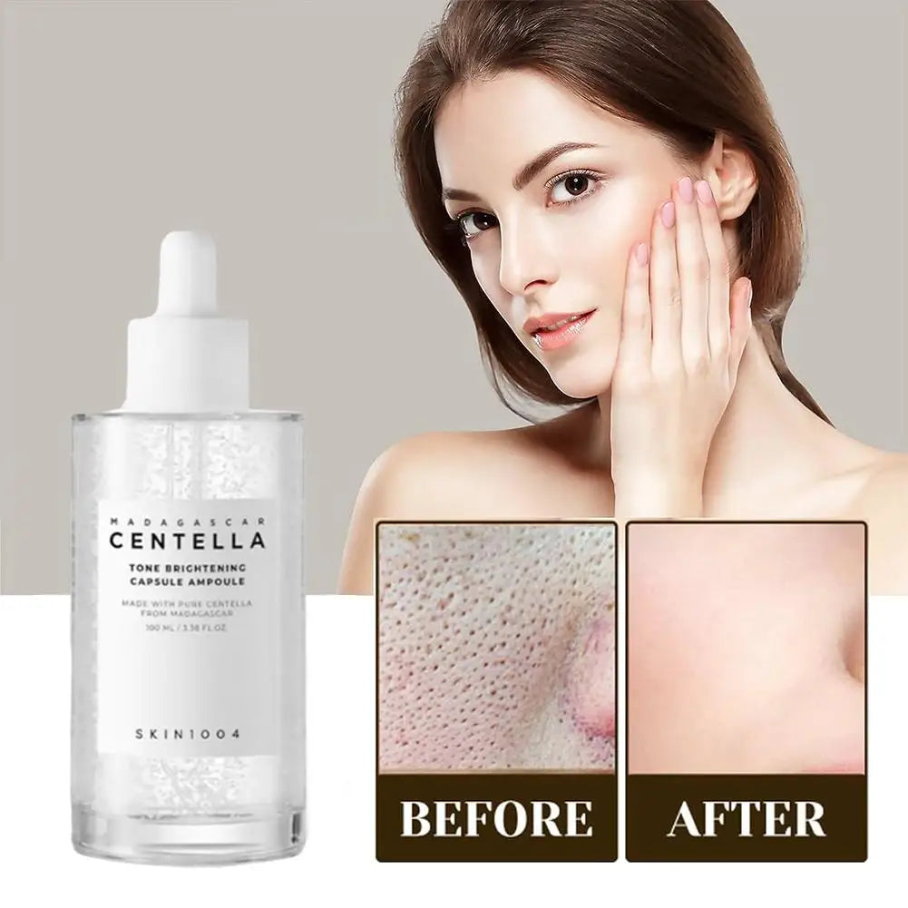Centella asiatica Serum, Intensive Moisturizing Improve Dry Skin Smooth And Tender Skin Brighten Hydrating Essence