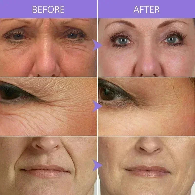 Centella Anti-Aging Serum Firming Lifting Brightening Anti-Wrinkle Deep Moisturizing Repair Dullness Korean Skincare Cosmetics