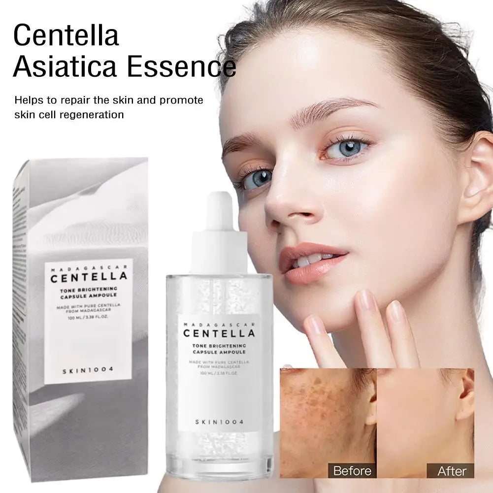 Centella asiatica Serum, Intensive Moisturizing Improve Dry Skin Smooth And Tender Skin Brighten Hydrating Essence