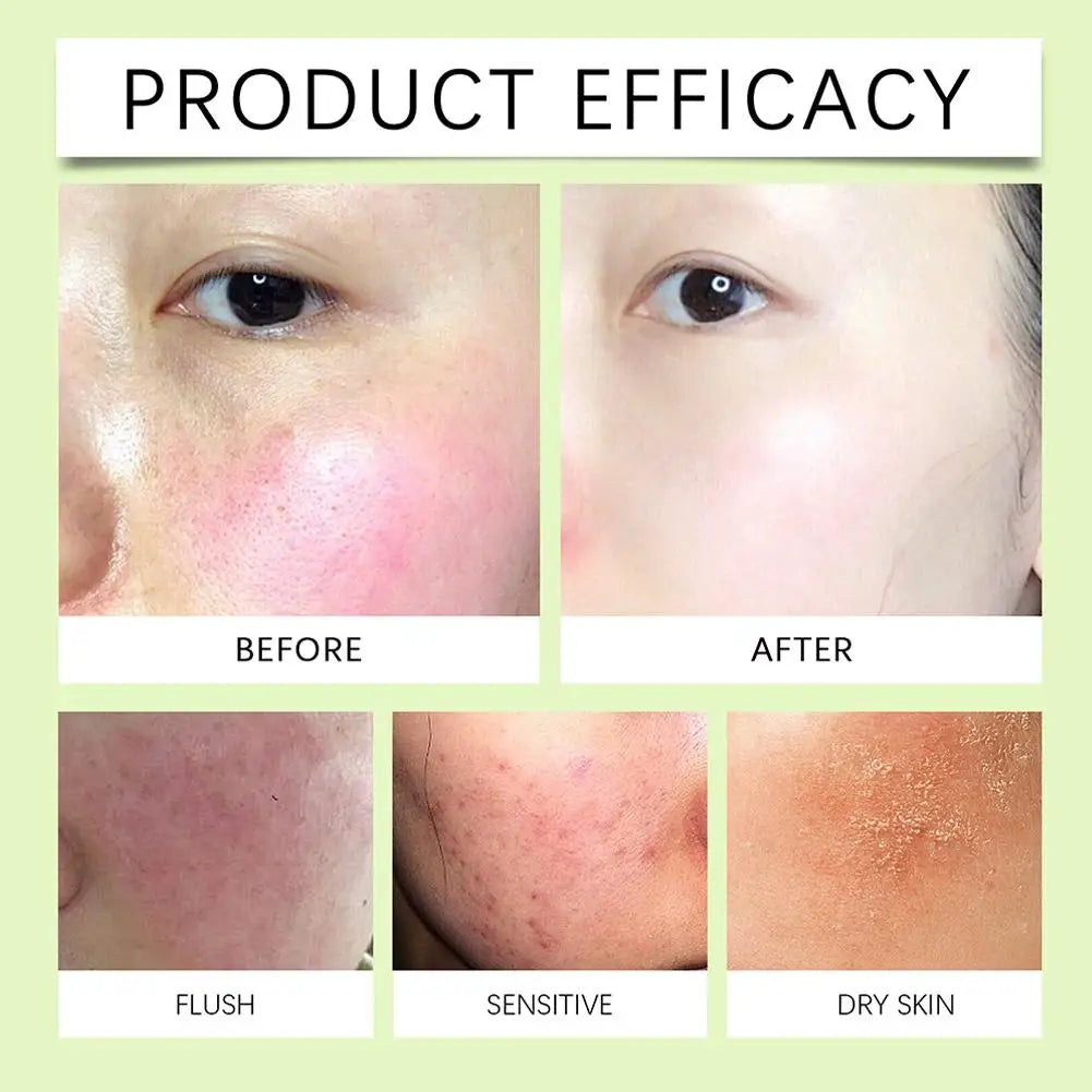 Centella Asiatica Soothing Moisturising facial Gel Deep Hydration Repairing Gel Skin Care For Women