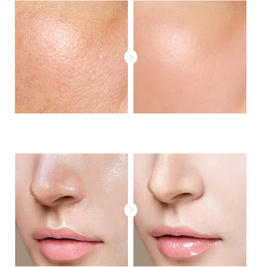 La Roche-Posay Hyaluronic Acid Serum 15ml for Hydration